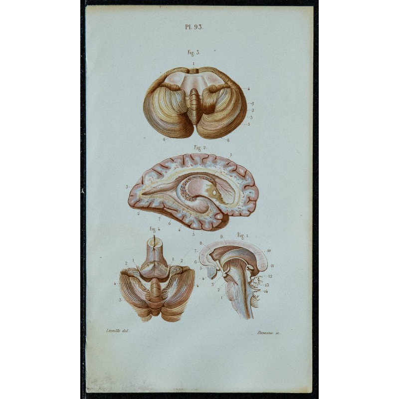 1852 - Ventricule latéral du cerveau 