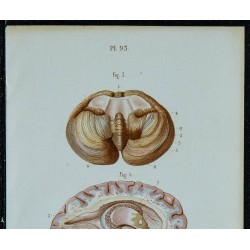 1852 - Ventricule latéral du cerveau 
