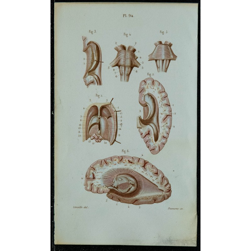 1852 - Coupes transversales du cerveau 