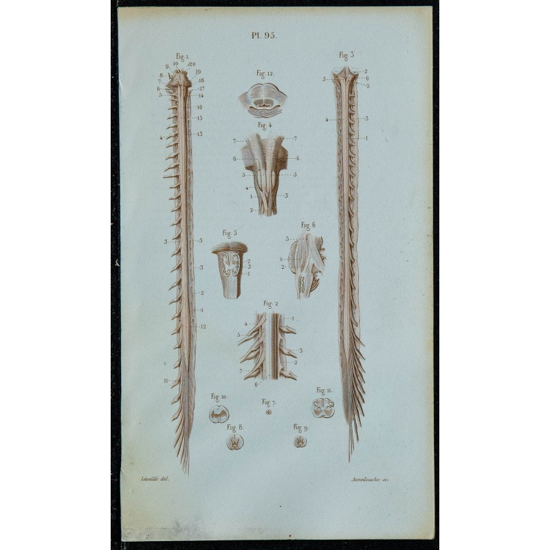 1852 - Moelle bulbe et protubérance 
