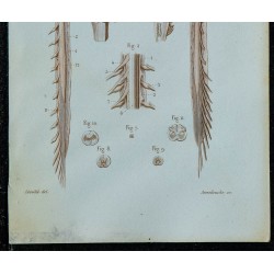 1852 - Moelle bulbe et protubérance 