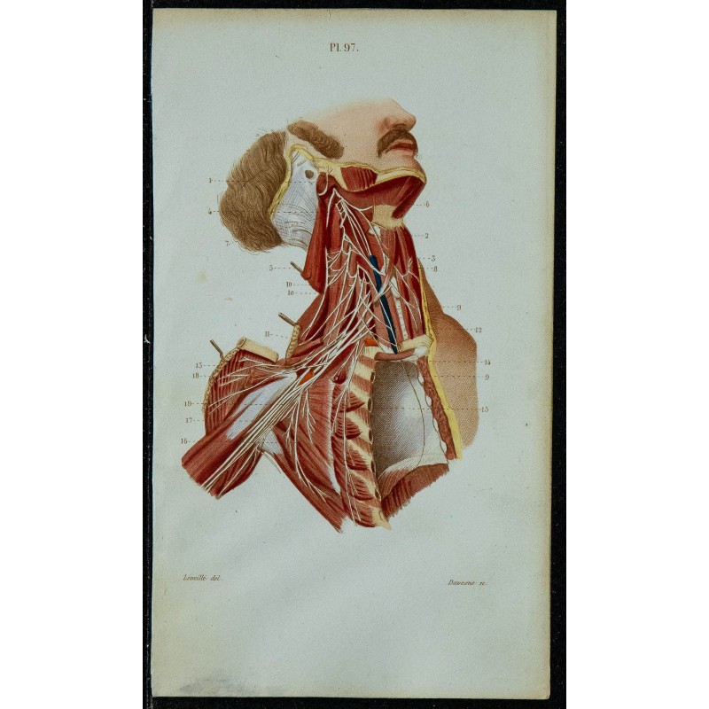 1852 - Plexus cervical & brachial 