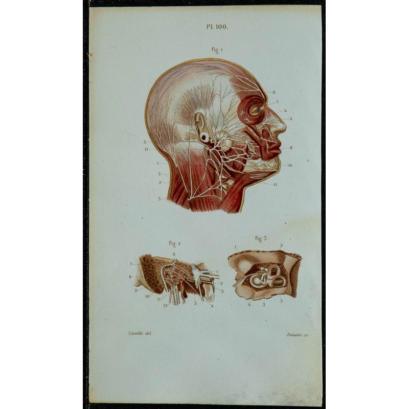 1852 - Nerf facial & auditif 
