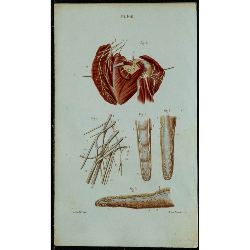 1852 - Plexus brachial et doigts 