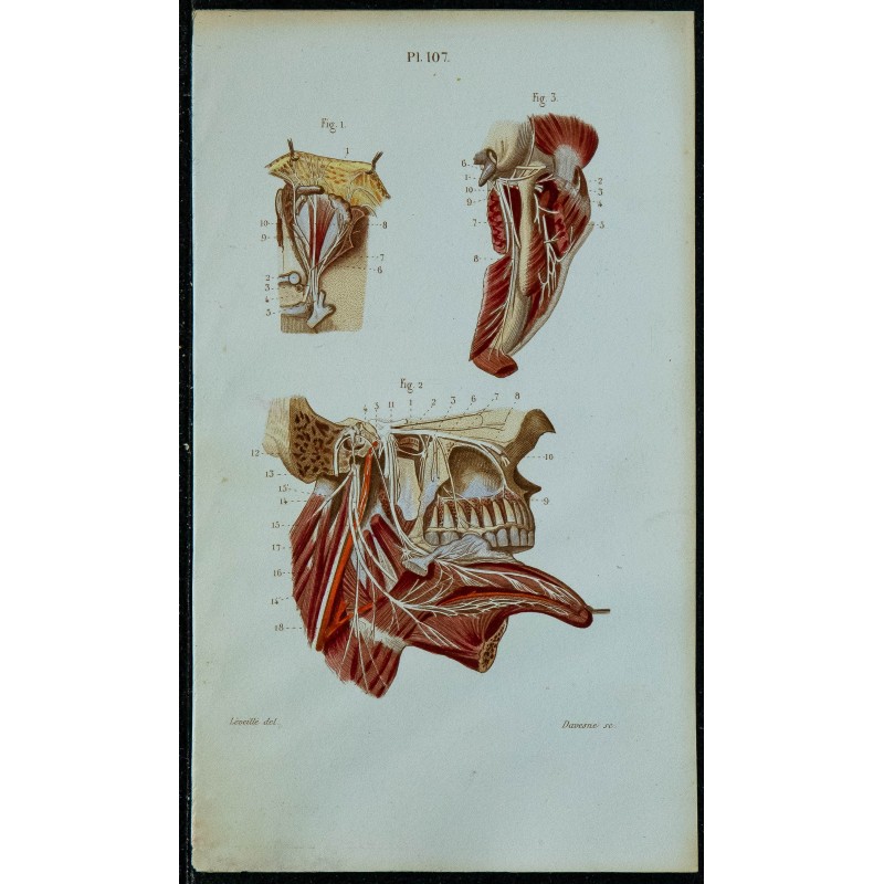 1852 - Nerf trijumeau & glosso-pharyngien 