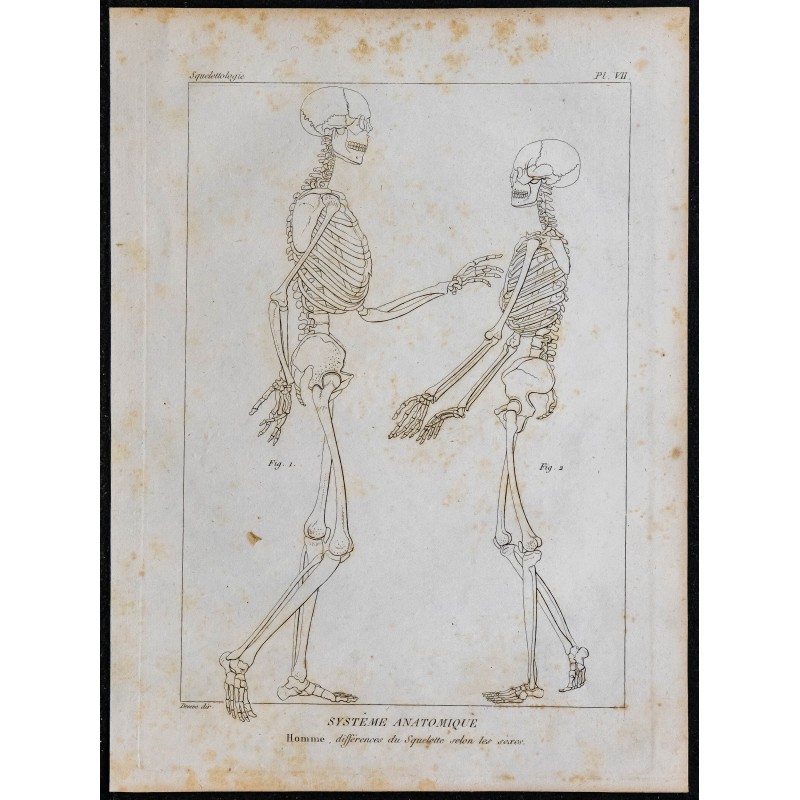 1825 - Squelette d'homme et de femme 