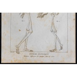 1825 - Squelette d'homme et de femme 