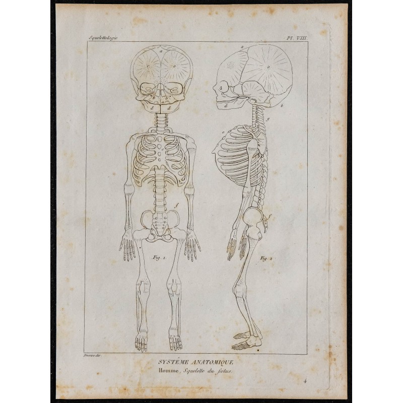 1825 - Squelette d'un foetus humain 