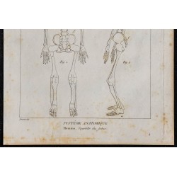 1825 - Squelette d'un foetus humain 