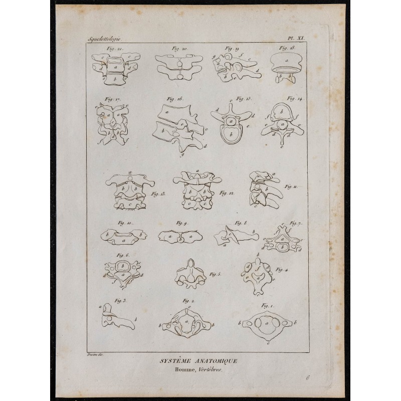 1825 - Vertèbres humaines 