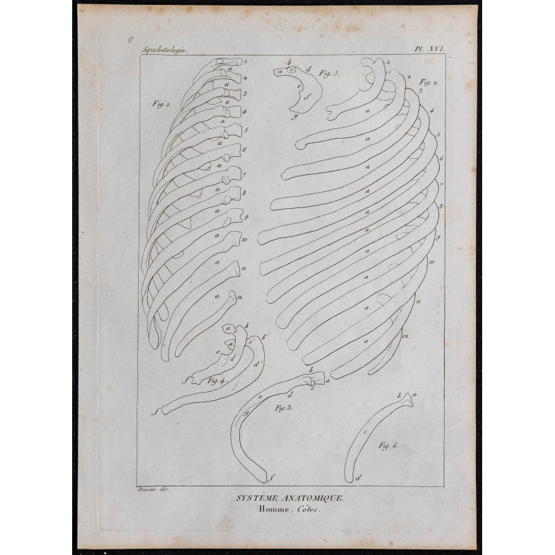 1825 - Côtes humaines 