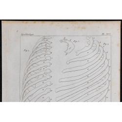 1825 - Côtes humaines 