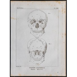 1825 - Crâne humain 