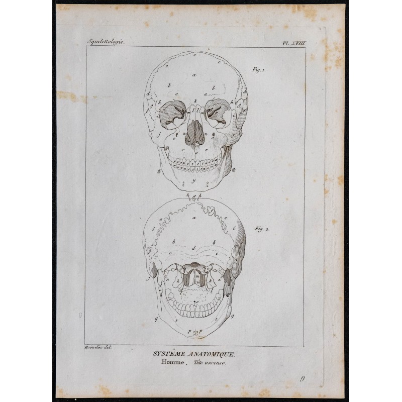 1825 - Crâne humain 