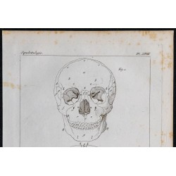 1825 - Crâne humain 