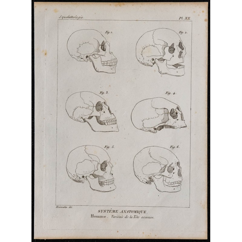 1825 - Variétés du crâne humain 