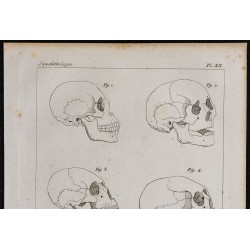 1825 - Variétés du crâne humain 