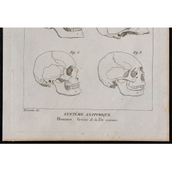 1825 - Variétés du crâne humain 