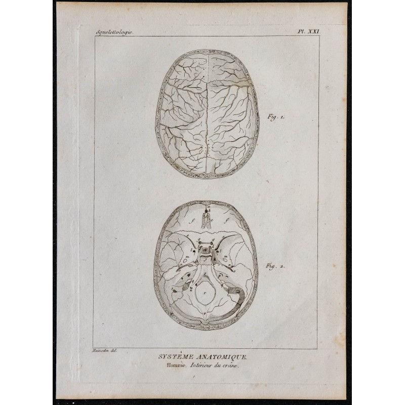 1825 - Intérieur du crâne humain 