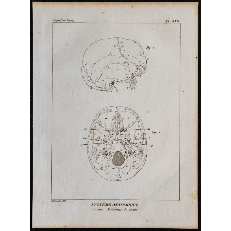 1825 - Crâne humain 