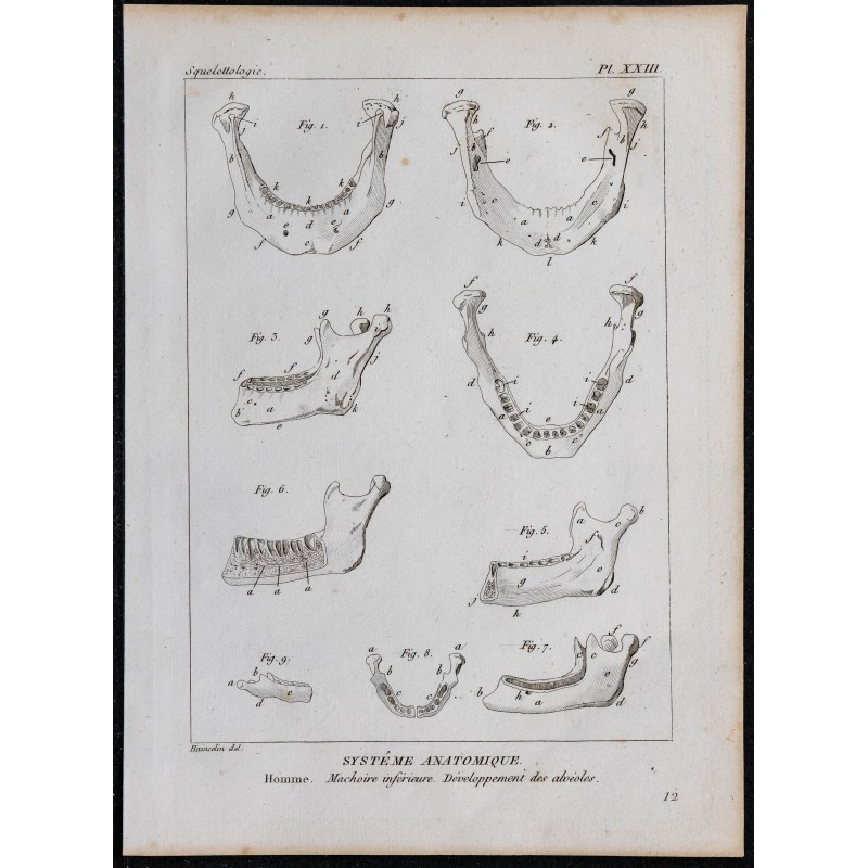 1825 - Mâchoire inférieure humaine 