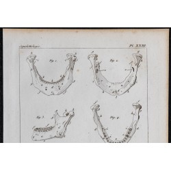 1825 - Mâchoire inférieure humaine 