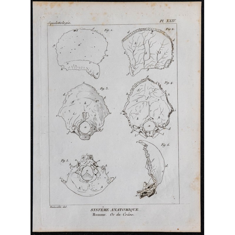 1825 - Crâne humain 
