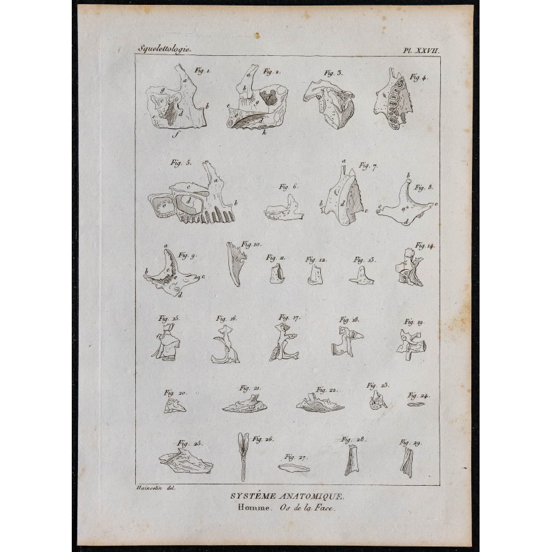 1825 - Os du visage humain 