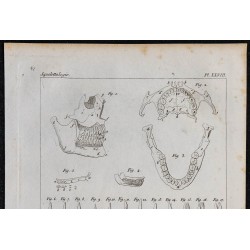 1825 - Crâne humain et dents 