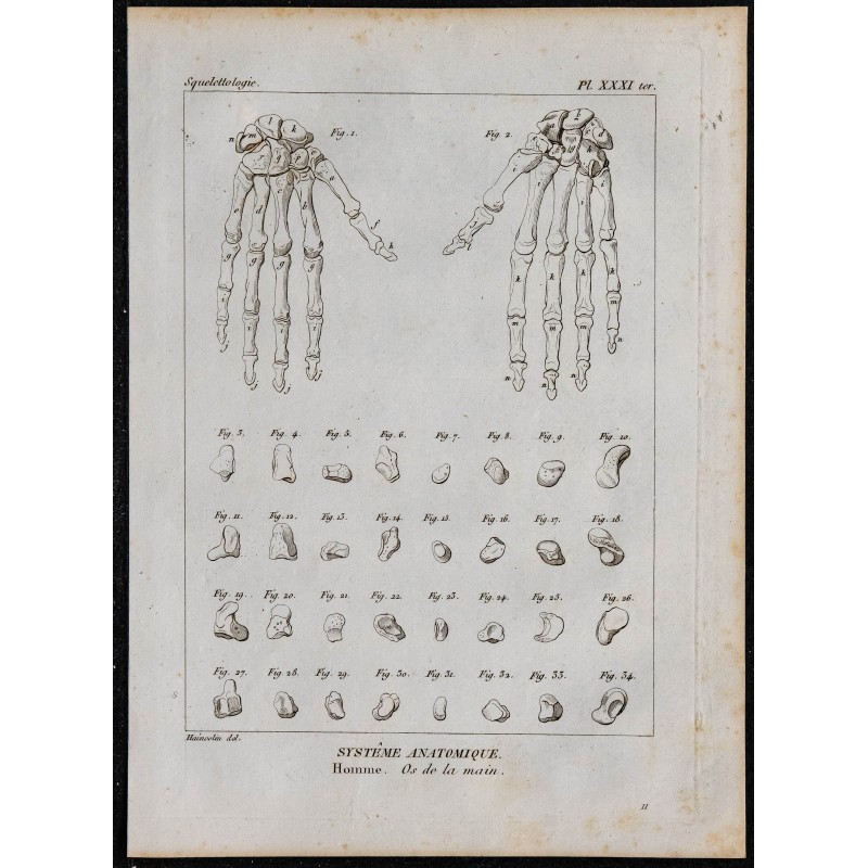 1825 - Os de la main humaine 
