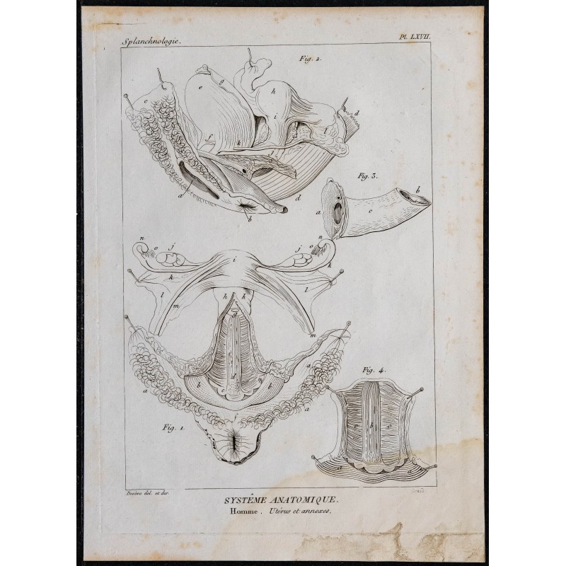 1825 - Utérus humain et ses annexes 