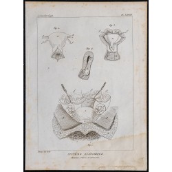1825 - Utérus humain et annexes 