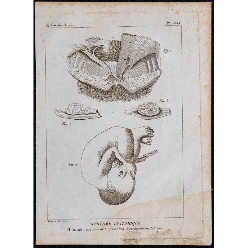 1825 - Développement du fœtus humain 
