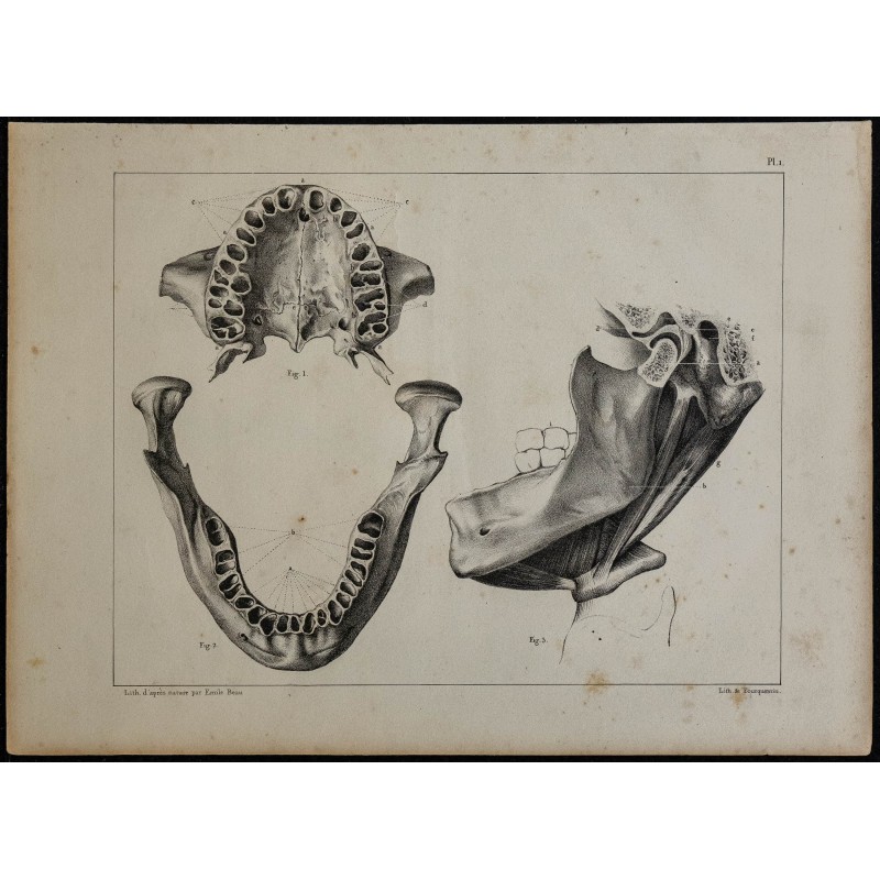 1839 - Mâchoires humaines et dentition 