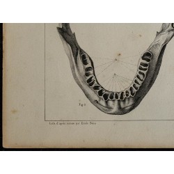 1839 - Mâchoires humaines et dentition 