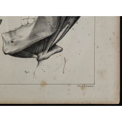 1839 - Mâchoires humaines et dentition 