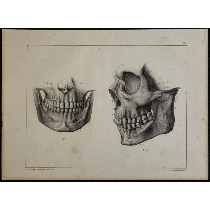 1839 - Mâchoires & dentition d'adulte 