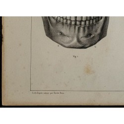 1839 - Mâchoires & dentition d'adulte 