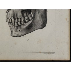1839 - Mâchoires & dentition d'adulte 