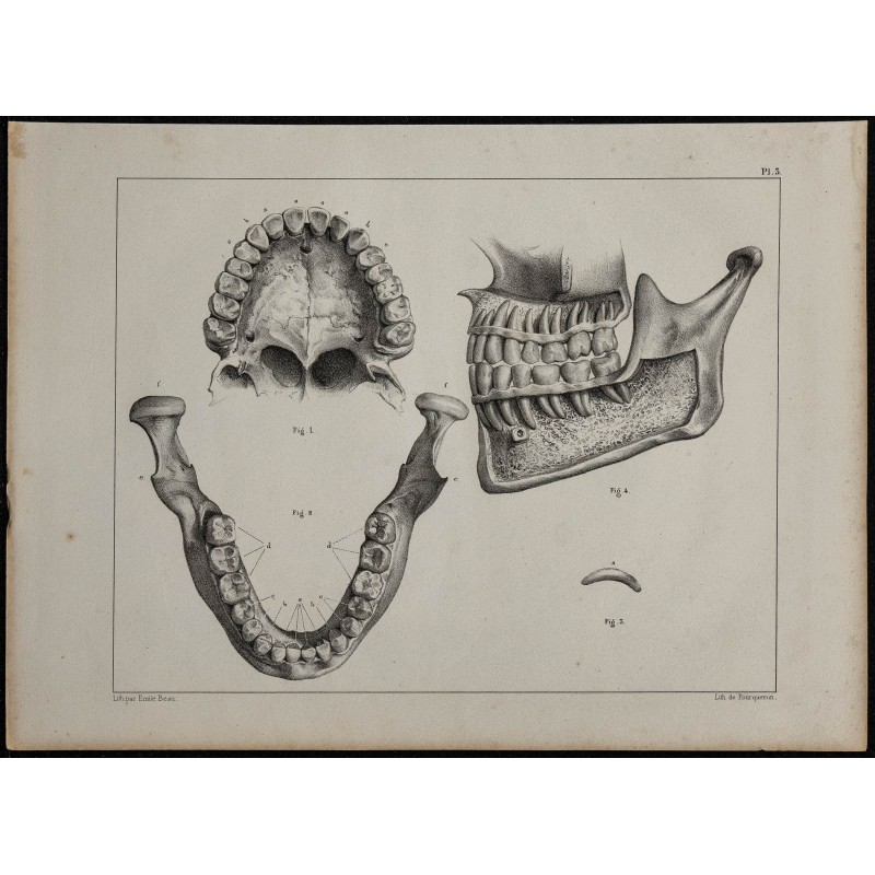 1839 - Dentition articulation & mandibule 