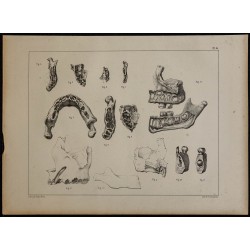 1839 - Mâchoires & dents des enfants 