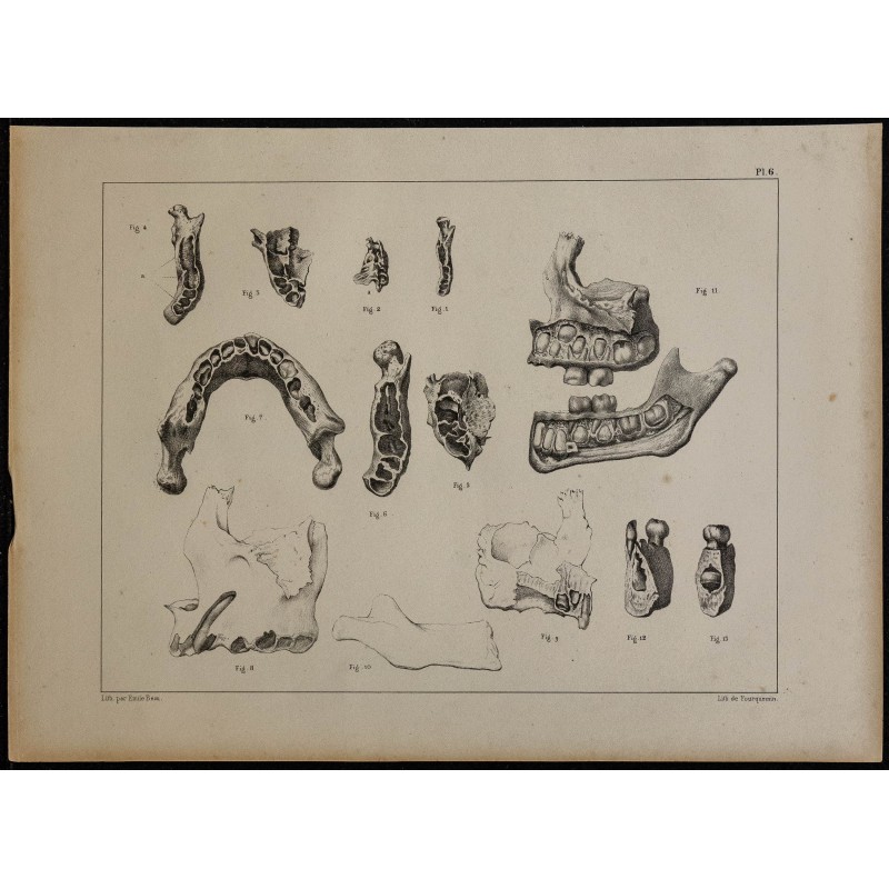 1839 - Mâchoires & dents des enfants 
