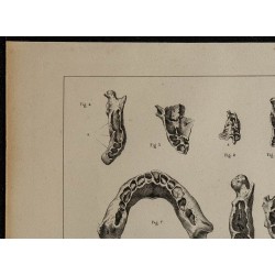 1839 - Mâchoires & dents des enfants 