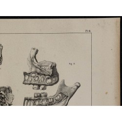 1839 - Mâchoires & dents des enfants 