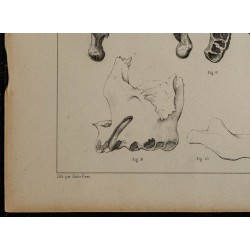 1839 - Mâchoires & dents des enfants 