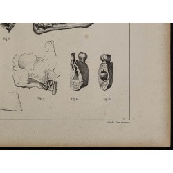 1839 - Mâchoires & dents des enfants 