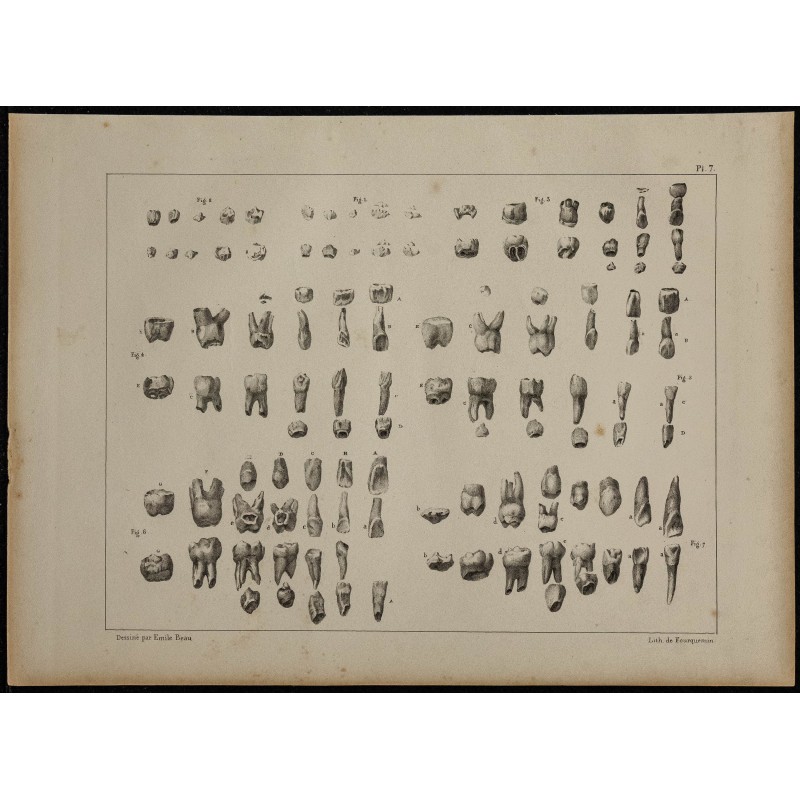 1839 - Évolution de la dentition des enfants 