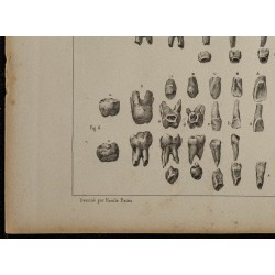 1839 - Évolution de la dentition des enfants 