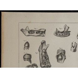 1839 - Développement des dents 