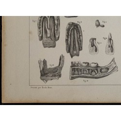 1839 - Développement des dents 
